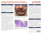 A Unique Case of Darier's Disease with Perioral Cutaneous Cobblestoning Treated with Dupilumab by Sara Holt, Sherlyn Saju, and Richard Miller