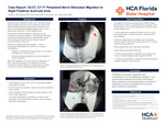 Case Report: C6-C7, C7-T1 Peripheral Nerve Stimulator Migration to Right Posterior Auricular Area by Allie Brodsky, Chad Taylor, Chloe Esch, and John Scott Adams