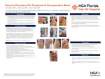 Panacos Procedure for Treatment of Uncooperative Warts by Val Haddon, Joel Santana, and Andra Achim