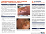 Strep pasteurianus Toxic Shock Syndrome Revealing Colon Adenocarcinoma by Kendal Hansen and Enrique Urrutia