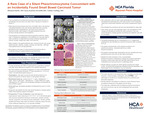 A Rare Case of a Silent Pheochromocytoma Concomitant with an Incidentally Found Small Bowel Carcinoid Tumor by Michael Salzle, Anna Szafran-Swietlik, and Tobias Carling