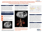 Redefining Resectability in Pancreatic Cancer: A Modified Appleby and Radical Antegrade Modular Pancreatosplenectomy Procedure with Concomitant Left Lateral Sectionectomy in A Patient with Replaced Right and Left Hepatic Arteries by Monica Sciturro, Nada Belal, and Jamii St. Julien