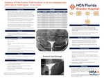 Incidence of False-Positive Tubal Occlusion on Hysterosalpingography (HSG) due to Tubal Spasm: A Case Series by Elena Korytnikova, Ben Duplaga, and Mark Sanchez
