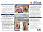When TNF Inhibition Backfires: A Rare Case of Etanercept Induced Pyoderma Gangrenosum by Don Woody, Julio Paoli-Gonzalez, and Adam Grunbaum