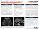 Breaking Bad Cells: Histotripsy as a Noninvasive Weapon Against HCC by Durga A. Kumar, Baylen Shoemaker, Rafik Lababidi, and Patricia Chun
