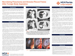 Necrotizing Pneumonia and Alveolar-Pleural Fistula After Foreign Body Aspiration by Vineet Madishetty, Adam Hurwitz, Ritvik Peesapati, Jessica Neugebauer, and James Flanagan