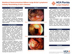 Multifocal Gastrointestinal Diffuse Large B-Cell Lymphoma Initially Resembling Crohn’s Disease