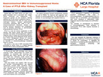 Gastrointestinal EBV in Immunosuppressed Hosts: A Case of PTLD After Kidney Transplant by Mary Moussa, Baylen Shoemaker, Vikas Sethi, Alvin Boyd Newman-Caro, Rakhee Shah, Patricia Chun, and Michael Schulman