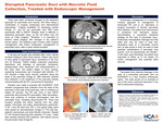 Disrupted Pancreatic Duct with Necrotic Fluid Collection, Treated with Endoscopic Management by Amir Aghaabdollah, Kelly Volland, and Anabel Rodriguez Loya
