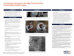 Free-Floating Thrombus in the Right Coronary Artery Complicating Unstable Angina by Marc Lozano, Andrew Sephien, Qitan Huang, and Aakash Patel